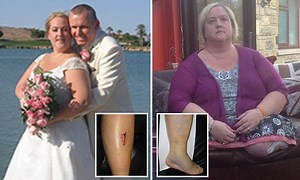 What is chronic pain? Thought-provoking video from 2015