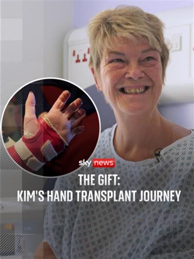 Kim Smith's Journey: Surviving Sepsis and Hand Transplant