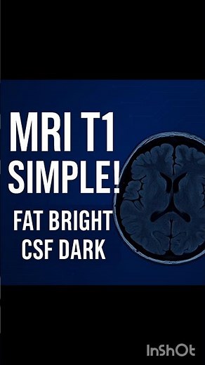 MRI basic E-:2: T1 Sequence Explained in 20 Seconds | Fat Bright, CSF Dark