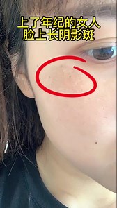 🙈🙈this ah my face need lor 🙈my face really so many 😄😄 $10/bot let's try Order 3week arrive | AAAshop.