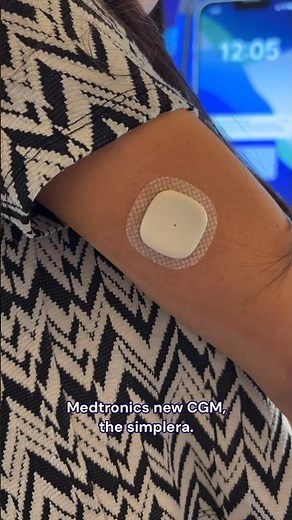 Testing the Medtronic Simplera CGM #t1d #diabetes