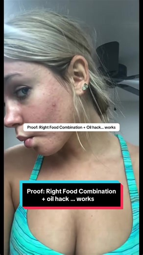 Have you ever looked in the mirror and wondered… Why your skin looks tired, inflamed, or constantly breaking out — even though you’re trying to take care of yourself? Most women never hear the real reason. Excess sugar slowly creates inflammation inside the body. And the skin is often the first place it shows. Acne. Puffiness. Dull, tired-looking skin. It’s not just about skincare. It’s about what the body is being fed every single day. When sugar drops… and the body finally gets clean, nourishi