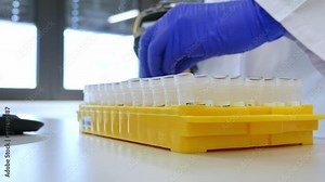 Lab technician or medical assistant scans patient samples into the patient database. laboratory technician uses barcode reader. genetic and cancer screening and medical technology and therapy.