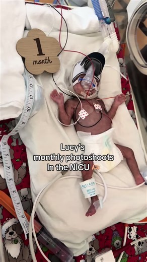 Lucy's NICU Photoshoots: Milestones Towards Home
