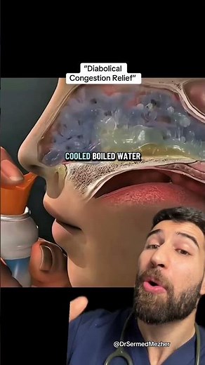 Doctor Gives 4 Ways to Relieve Congestion #how