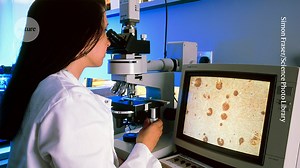 1984: Identifying amyloid-β in brain plaques