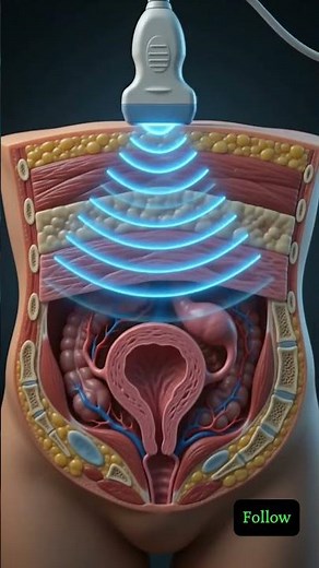 How does an ultrasound see your baby?