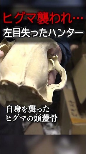 「ガリガリと頭をかじられ...」熊に襲われ左目失ったハンター 壮絶な当時の状況語る（2026年2月17日）#shorts