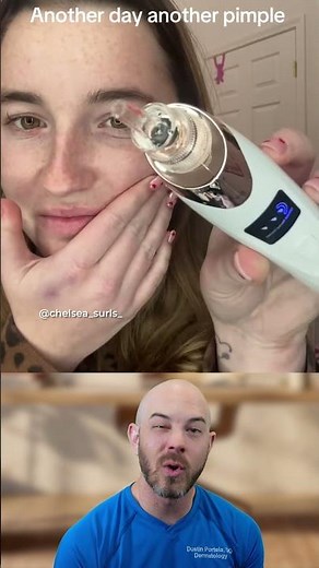 Removing Pimples with a Pore Vacuum #skincare #pimple