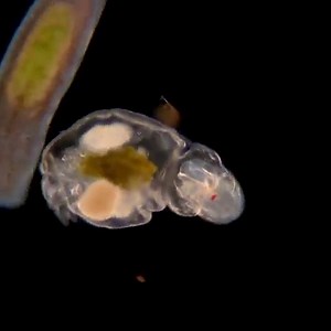 This tiny animal is called a rotifer, and all of the other organisms zooming by are fellow inhabitants from the small pond it came from. Turn up the volume for a full breakdown of what is happening in this epic pond scene. #MicroscopicMonday 🧫🔬 caption by Martin Kaae Kristiansen (My Microscopic World | Science Channel