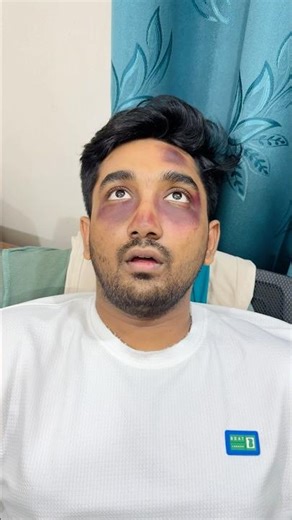 বাঙালি ভাই উপরে চলে গেলো 🤣 | Mother Vs Son