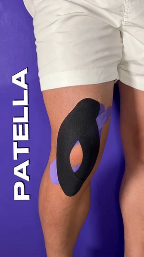 Kinesiotape does not replace strengthening, but it is an excellent complement to improve alignment, reduce pain, and enhance patellofemoral stability while working on muscular recovery. #kneepain #patella #kinesiotape #fblifestyle | Kinetape Academy