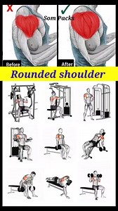 106K views · 844 reactions | Rounded shoulder exercises ✅ | Som Packs | Facebook