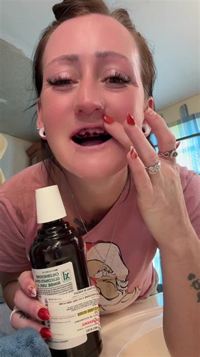 Coping with Dentures After 5 Days of Adjustment