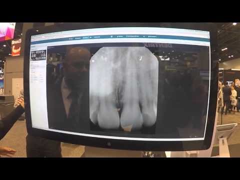 What the clinical team needs to know about Dentrix Ascend