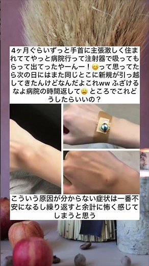 これ何！？何回も復活する謎のしこり😱 #健康 #謎