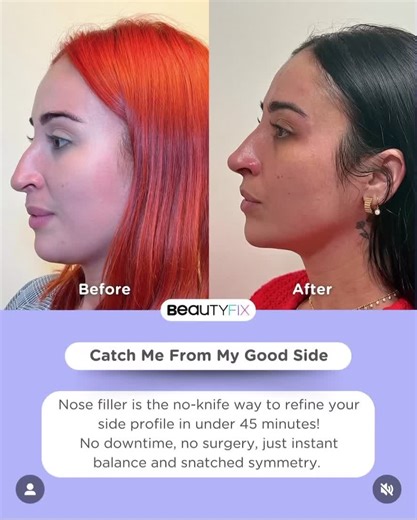 injector_mimi on TikTok