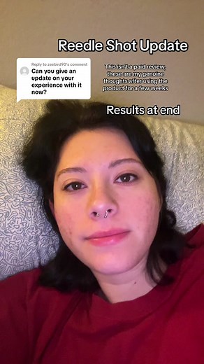 Replying to @zeebird90 #skincare #skincareroutine #reedle #reedleshot100 #vtcosmetics #productreview #skintexture #smoothingtreatment #hyperpigmentation