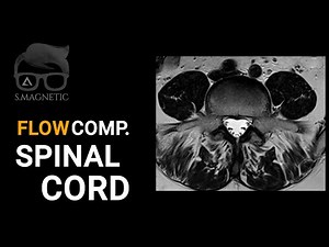 FLOW COMPENSATION – SPINAL CORD