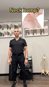 Neck humps can have various causes such as Cushing’s Syndrome. If it’s due to posture this exercise may help! | Prime Performance Chiropractic & Wellness Clinic