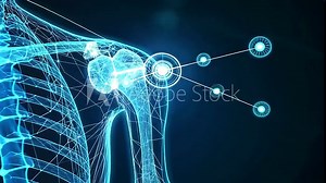 Futuristic trauma scan of a broken shoulder blade, enhanced with blue radiographic highlights. Neural network visualization processes the fracture, aiding AI-driven diagnosis.