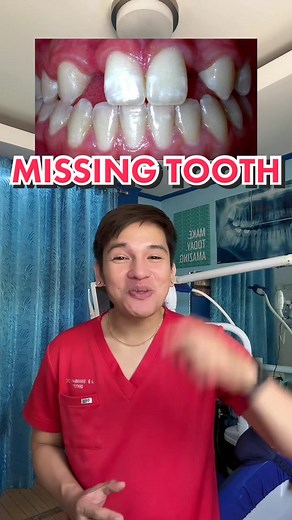 Understanding Hypodontia: Causes and Solutions