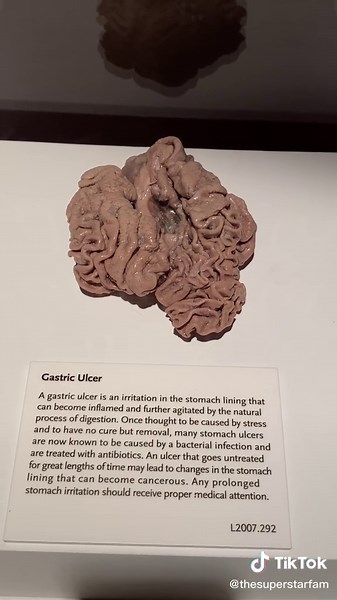 Have you checked out the Bodies Exhibition in Luxor! 😲 Everything inside is preserved body parts!🤭 #luxor #body #organ #bodies #vegas #exhibition #lasvegas #vegasattractions #casino