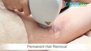 1M views · 439 reactions | Have a hairless Holiday with Diode Laser...