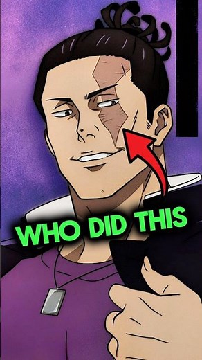 How Did Todo Get That Scar on His Face!?