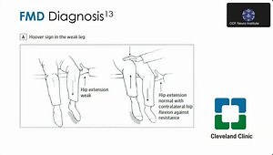 Functional Neurological Disorders: Physical Therapy Evaluation and Treatment for Beginners