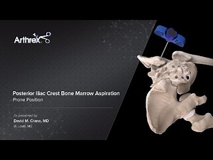 Posterior Iliac Crest Bone Marrow Aspiration - Prone Position
