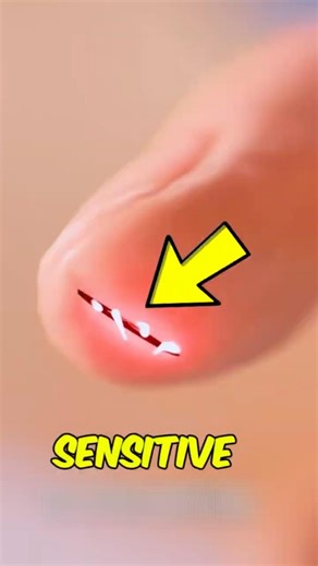 Why Do Paper Cuts Hurt SO Much? The Painful Truth Explained!