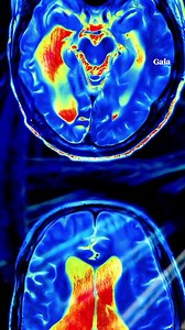 632K views · 12K reactions | Que feriez-vous si l'on vous annonçait...