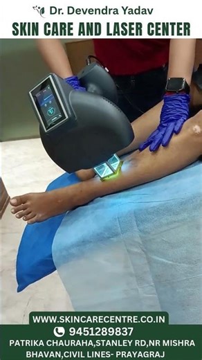 White Spots on Skin? Get Clearer Skin with Advanced Laser Treatment!