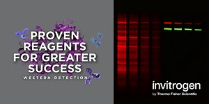 A Novel Method for Quantitative  Western Blotting that Eliminates Errors from the Use of  Housekeeping Proteins