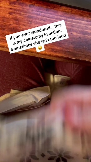 Perk.. i can poop anywhere. #colostomybag #poopbag #colostomy | colostomy bag