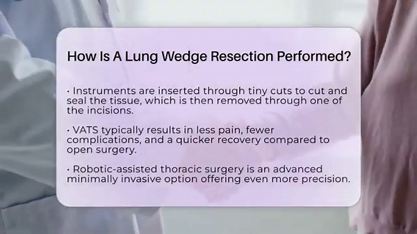 How Is A Lung Wedge Resection Performed? - Lung Cancer Support Hub