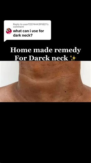 DIY Turmeric Scrub for Dark Neck | Home Remedy Tips