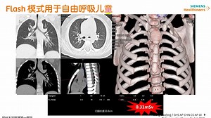 CT胸部疾病的高级应用与科研