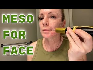 Mesotherapy with Hyaluron Pen