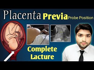 How to Scan Placenta Previa | Correct Probe Position Explain by Dr Ali Waqar