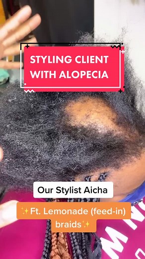 Our Braiding Specialist styles w/ Alopecia #hairtransformation #alopecia #braidstutorial