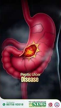 🩺 Fatty Liver: Signs, Causes & Treatment | Dr. Bincy, Consultant Gastroenterologist 💚