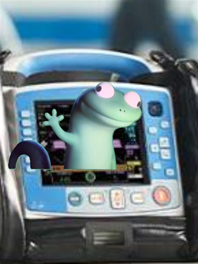 Humorous EMT Moments: Misreads on the Monitor