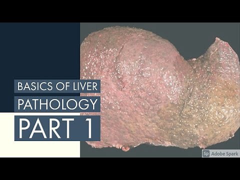 📚 BASICS OF LIVER PATHOLOGY II PART 1 II SYSTEMIC PATHOLOGY II LIVER II ROBBINS 10TH EDITION