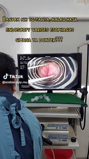 ENDOSCOPY RSU IMELDA MEDAN on TikTok