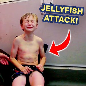 9 year old is freaking out after being stung by a brutal jellyfish! 😱 | Real Life Rescue