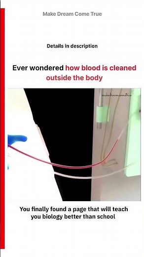 🧪 Ever wondered how 🩸 blood is cleaned outside the body ⚙️ | MDCT