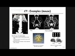 4.2 - Computed tomography - Image reconstruction/backprojection