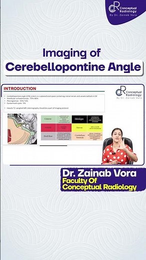 Imaging of Cerebellopontine Angle by Dr. Zainab Vora | Radiology Residency | Conceptual Radiology